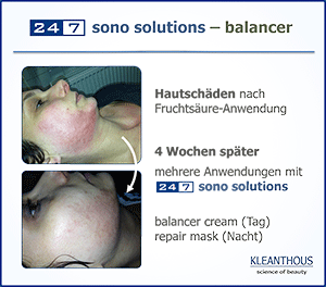 24/7 sono solution balancer