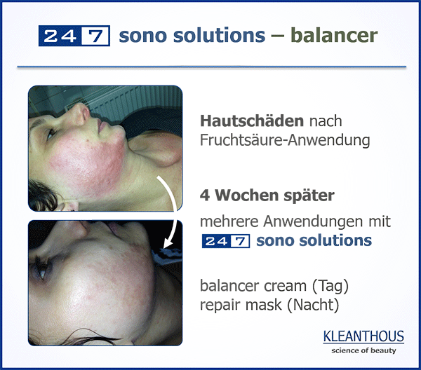 24/7 sono solution balancer